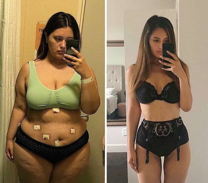 Girls before and after weight loss with KETO Complete capsules